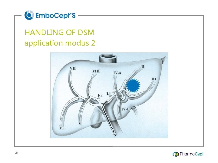 HANDLING OF DSM application modus 2 20 