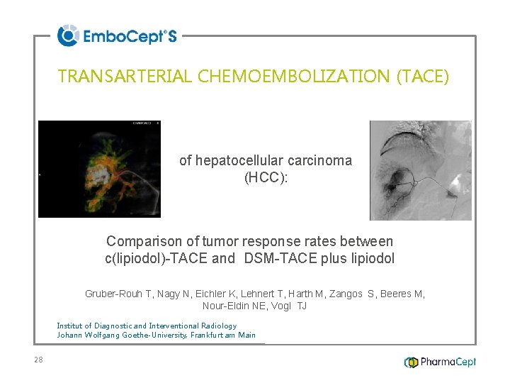 TRANSARTERIAL CHEMOEMBOLIZATION (TACE) of hepatocellular carcinoma (HCC): Comparison of tumor response rates between c(lipiodol)-TACE