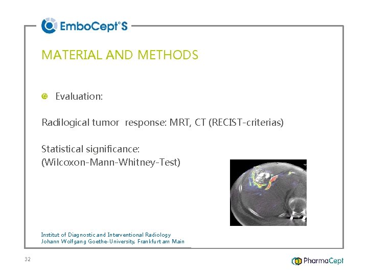 MATERIAL AND METHODS Evaluation: Radilogical tumor response: MRT, CT (RECIST-criterias) Statistical significance: (Wilcoxon-Mann-Whitney-Test) Institut