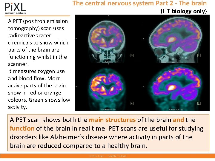 The central nervous system Part 2 - The brain (HT biology only) A PET