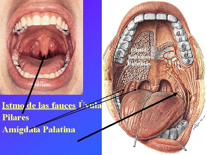 Glánd. Salivares Palatinas Istmo de las fauces Úvula Pilares Amígdala Palatina 