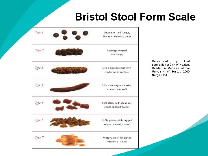 Bristol Stool Form Scale Reproduced by kind permission of Dr K W Heaton, Reader