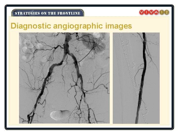 Diagnostic angiographic images 