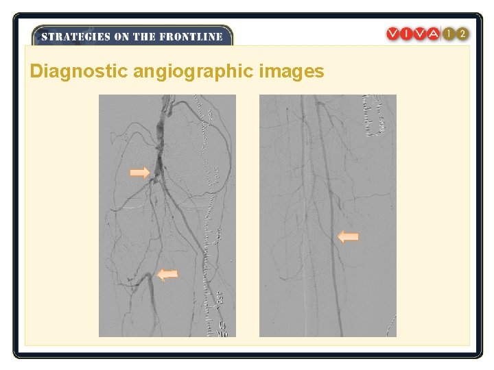 Diagnostic angiographic images 