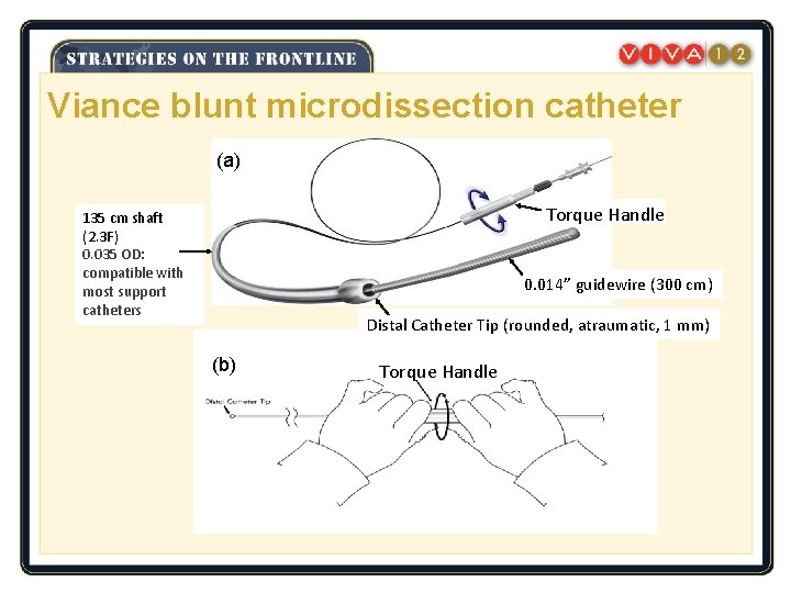 Viance blunt microdissection catheter (a) Torque Handle 135 cm shaft (2. 3 F) 0.