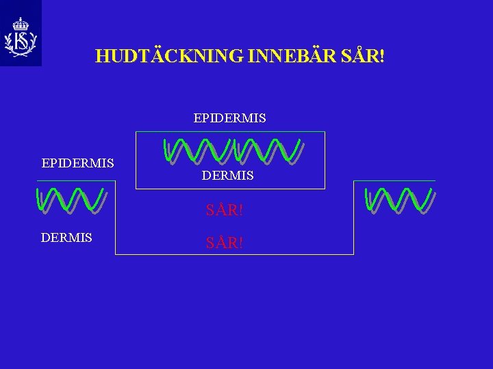 HUDTÄCKNING INNEBÄR SÅR! EPIDERMIS SÅR! 