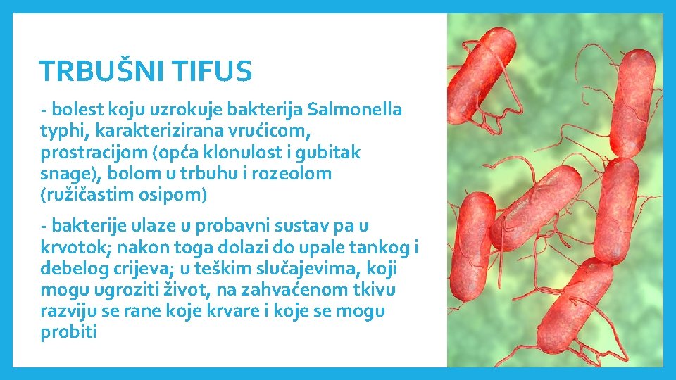 TRBUŠNI TIFUS - bolest koju uzrokuje bakterija Salmonella typhi, karakterizirana vrućicom, prostracijom (opća klonulost