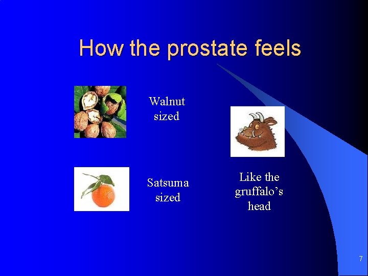 How the prostate feels Walnut sized Satsuma sized Like the gruffalo’s head 7 