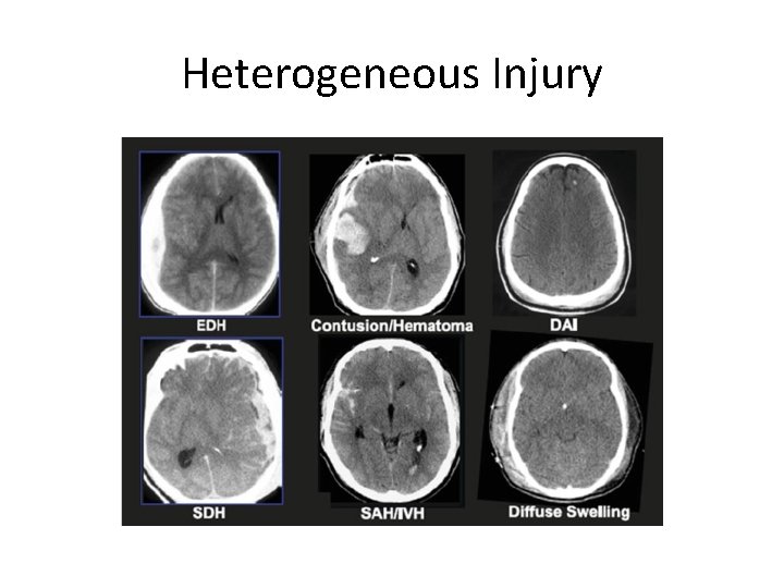 Heterogeneous Injury 