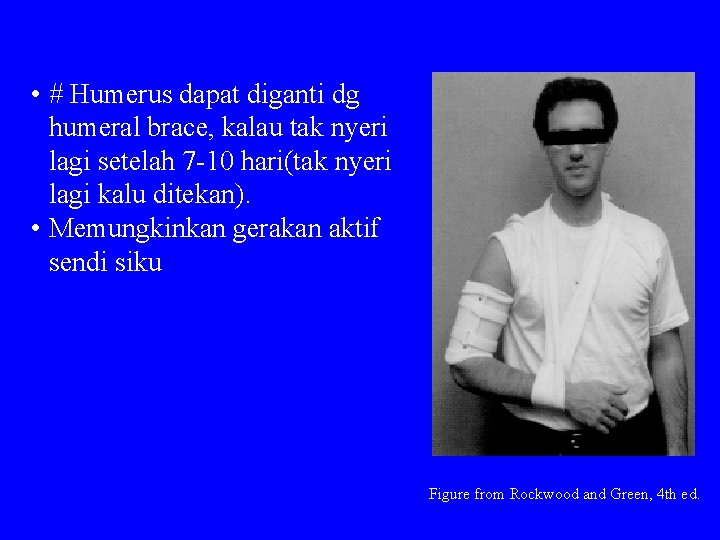  • # Humerus dapat diganti dg humeral brace, kalau tak nyeri lagi setelah