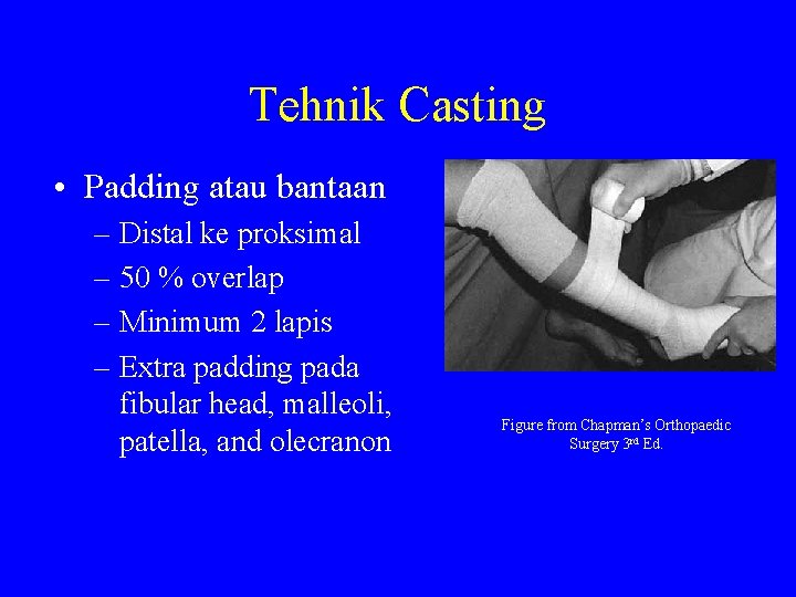 Tehnik Casting • Padding atau bantaan – Distal ke proksimal – 50 % overlap