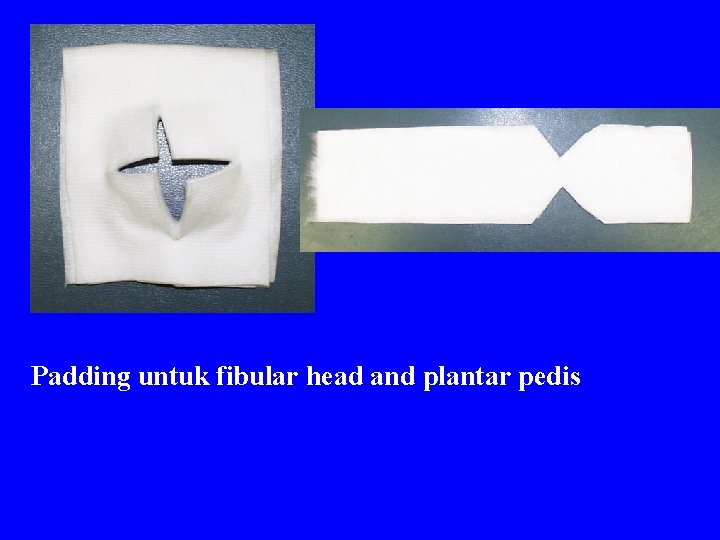 Padding untuk fibular head and plantar pedis 