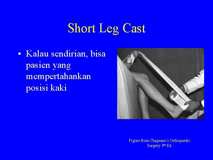 Short Leg Cast • Kalau sendirian, bisa pasien yang mempertahankan posisi kaki Figure from