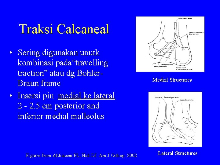 Traksi Calcaneal • Sering digunakan unutk kombinasi pada“travelling traction” atau dg Bohler. Braun frame
