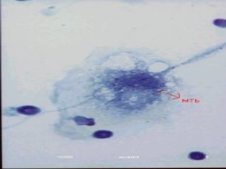 11/27/2020 alen vukelić, dr 15 