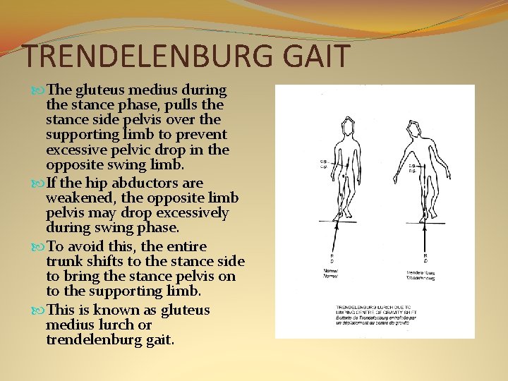 TRENDELENBURG GAIT The gluteus medius during the stance phase, pulls the stance side pelvis