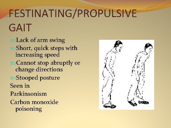 FESTINATING/PROPULSIVE GAIT Lack of arm swing Short, quick steps with increasing speed Cannot stop