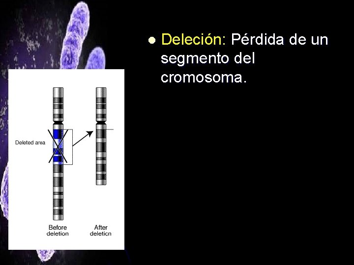 l Deleción: Pérdida de un segmento del cromosoma. 