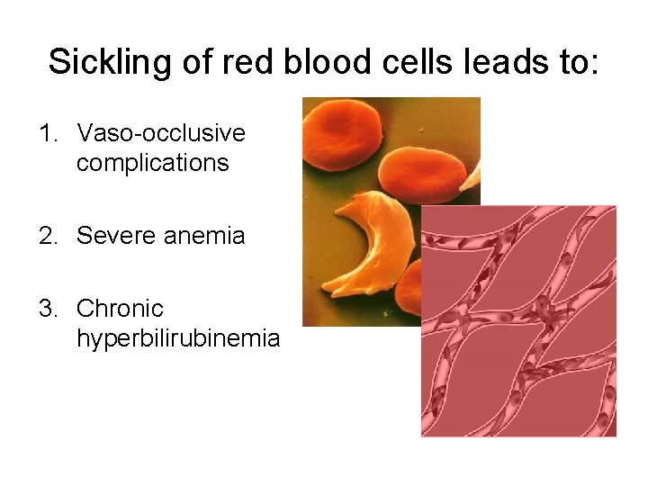 Sickling of red blood cells leads to: 1. Vaso-occlusive complications 2. Severe anemia 3.