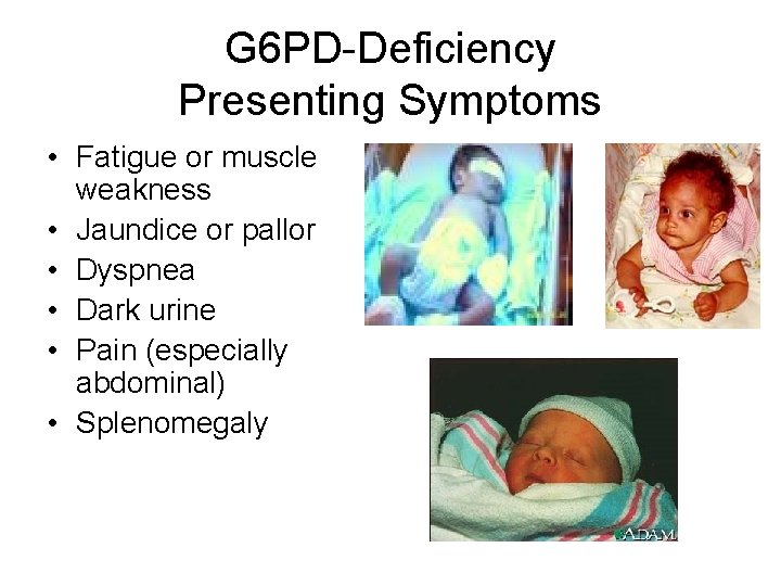 G 6 PD-Deficiency Presenting Symptoms • Fatigue or muscle weakness • Jaundice or pallor