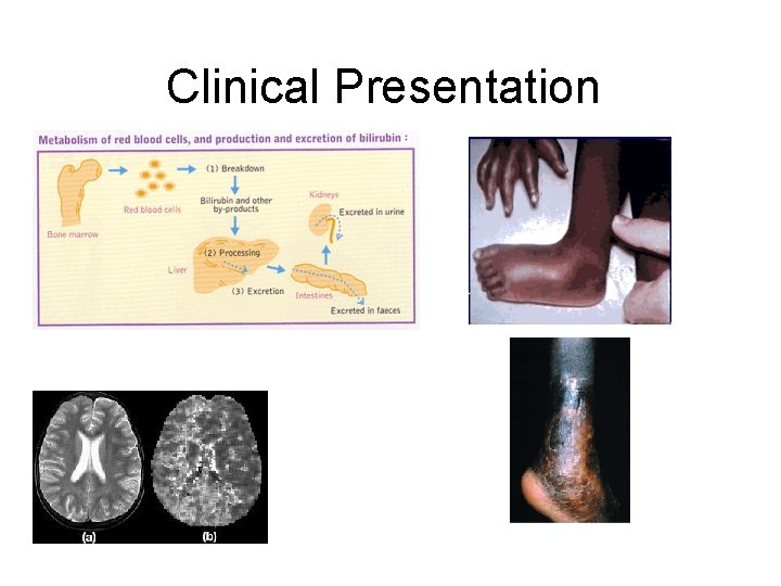 Clinical Presentation • There a range of Treatments per extremes or per symptoms 