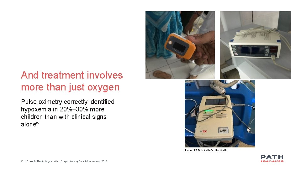 And treatment involves more than just oxygen Pulse oximetry correctly identified hypoxemia in 20%–