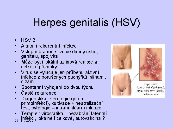 Herpes genitalis (HSV) • HSV 2 • Akutní i rekurentní infekce • Vstupní branou