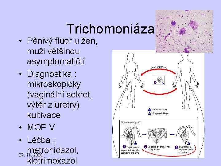 Trichomoniáza • Pěnivý fluor u žen, muži většinou asymptomatičtí • Diagnostika : mikroskopicky (vaginální
