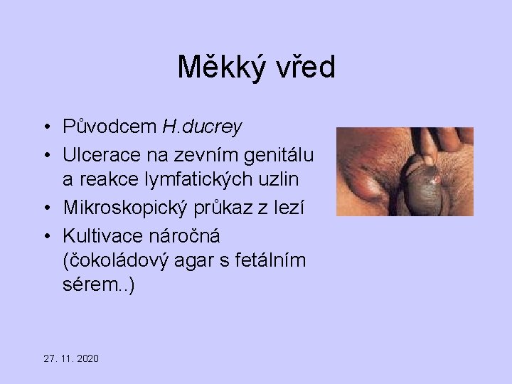 Měkký vřed • Původcem H. ducrey • Ulcerace na zevním genitálu a reakce lymfatických