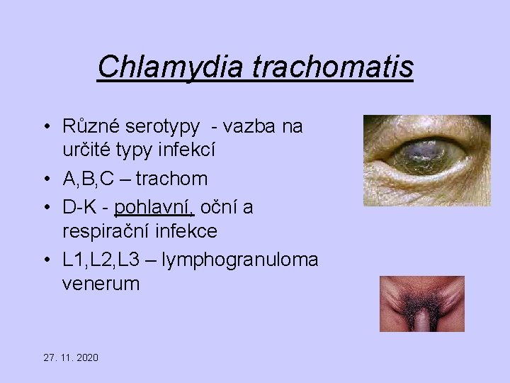 Chlamydia trachomatis • Různé serotypy - vazba na určité typy infekcí • A, B,