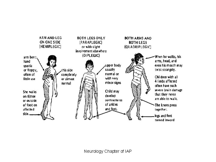 Neurology Chapter of IAP 