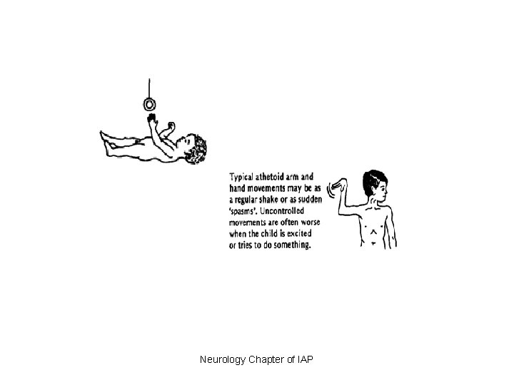 Neurology Chapter of IAP 