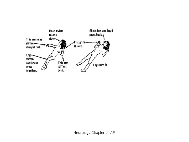 Neurology Chapter of IAP 