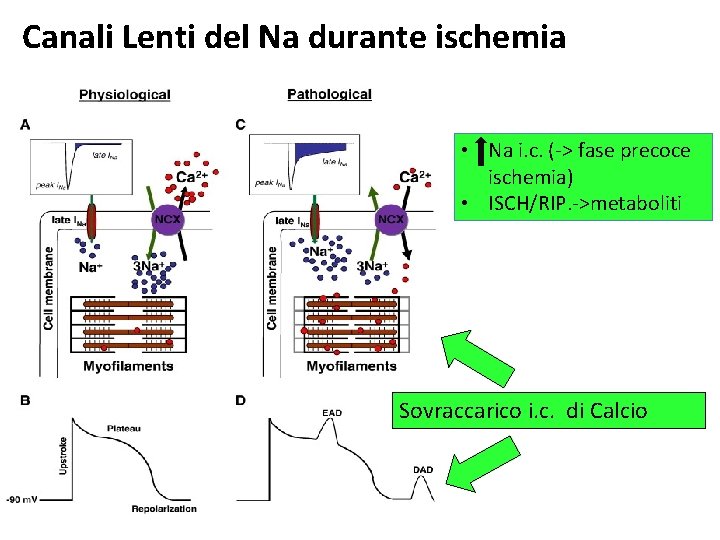 Canali Lenti del Na durante ischemia • Na i. c. (-> fase precoce ischemia)