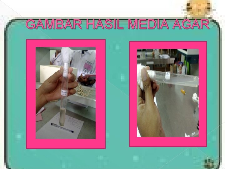 GAMBAR HASIL MEDIA AGAR GAMBAR HASIL MEDIA AGAR