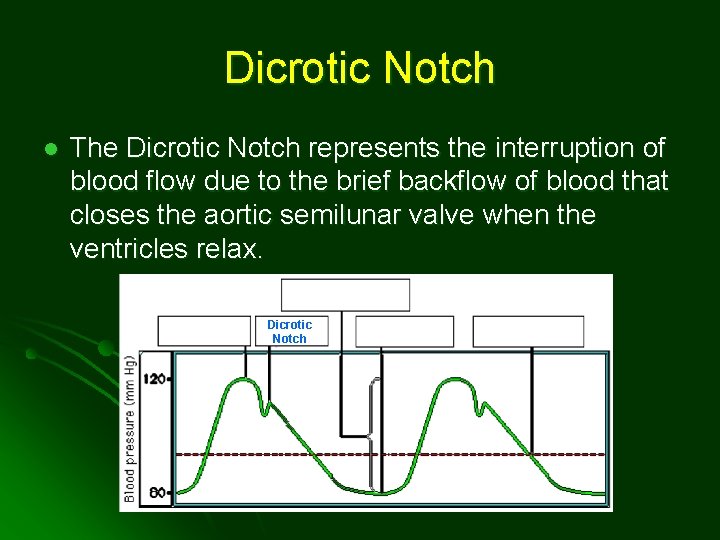 Dicrotic Notch l The Dicrotic Notch represents the interruption of blood flow due to
