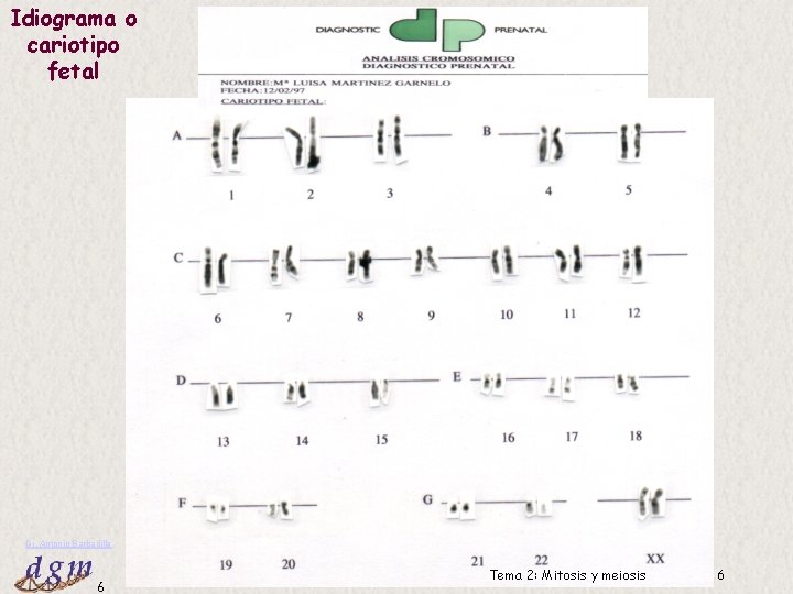 Idiograma o cariotipo fetal Dr. Antonio Barbadilla 6 Tema 2: Mitosis y meiosis 6