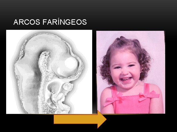 ARCOS FARÍNGEOS 