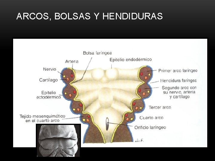 ARCOS, BOLSAS Y HENDIDURAS 