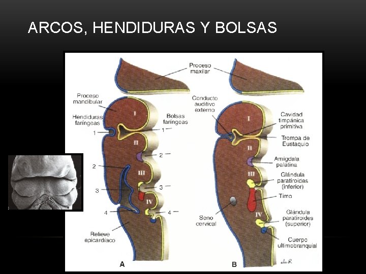 ARCOS, HENDIDURAS Y BOLSAS 