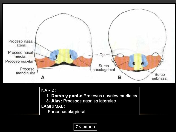 NARIZ: 1 - Dorso y punta: Procesos nasales mediales 3 - Alas: Procesos nasales