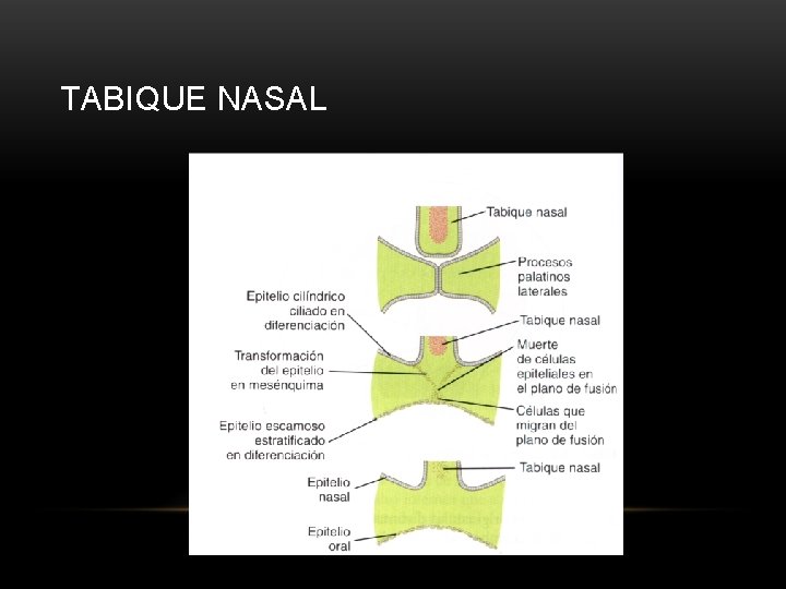 TABIQUE NASAL 