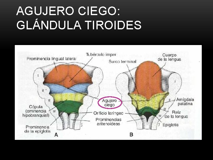 AGUJERO CIEGO: GLÁNDULA TIROIDES 