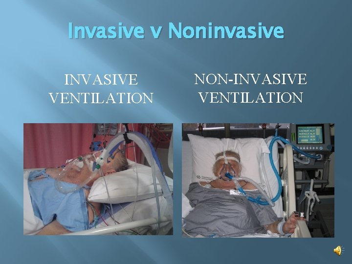 Invasive v Noninvasive INVASIVE VENTILATION NON-INVASIVE VENTILATION 