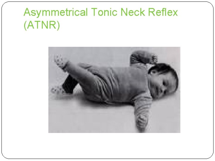 Asymmetrical Tonic Neck Reflex (ATNR) 