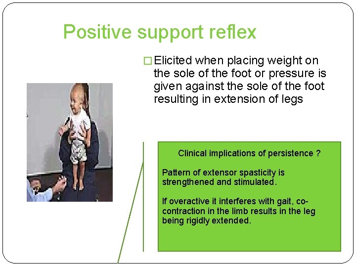 Positive support reflex � Elicited when placing weight on the sole of the foot