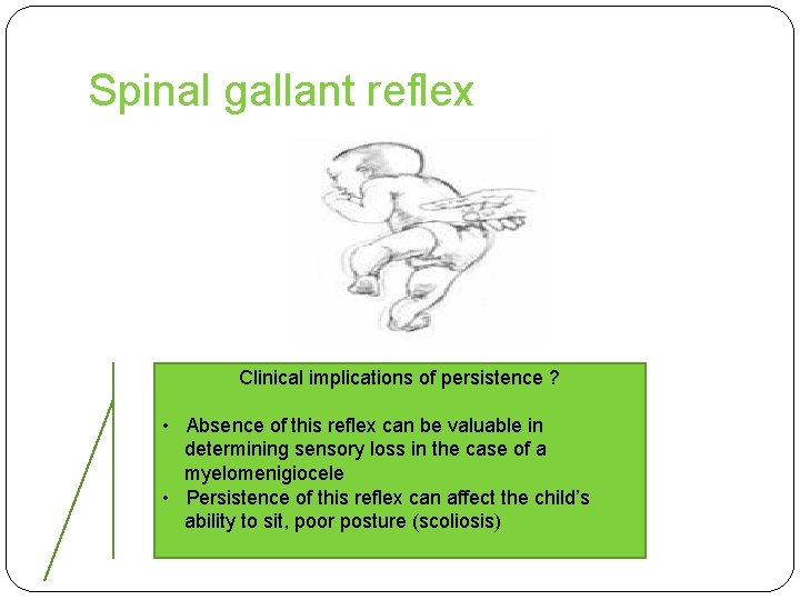 Spinal gallant reflex Clinical implications of persistence ? • Absence of this reflex can