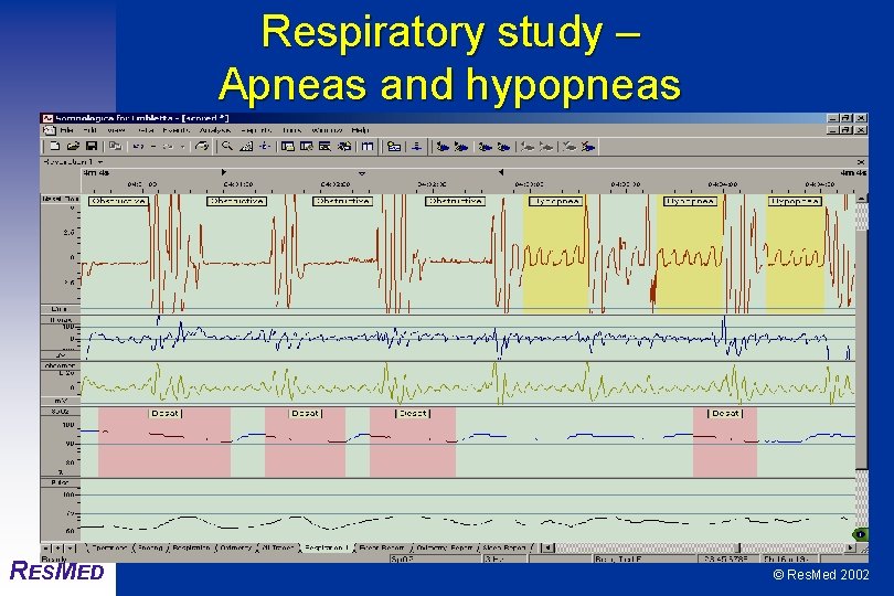 Respiratory study – Apneas and hypopneas RESMED © Res. Med 2002 