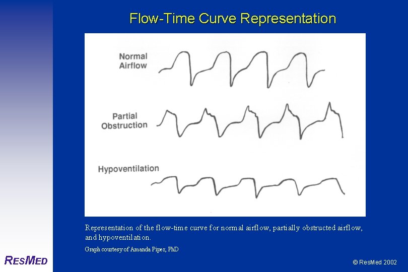 Flow-Time Curve Representation of the flow-time curve for normal airflow, partially obstructed airflow, and