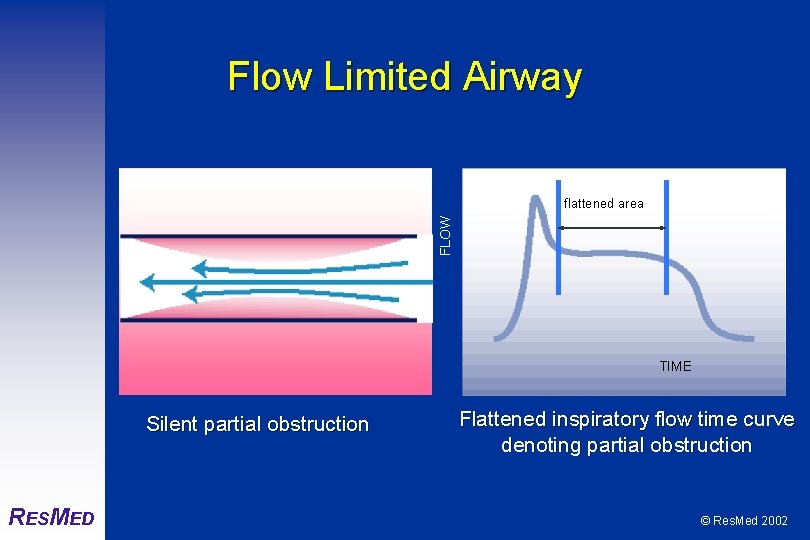 Flow Limited Airway FLOW flattened area TIME Silent partial obstruction RESMED Flattened inspiratory flow